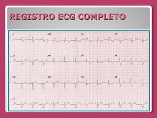 REGISTRO ECG COMPLETO 