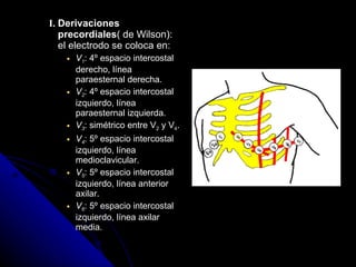 I. Derivaciones precordiales ( de Wilson): el electrodo se coloca en:  V 1 : 4º espacio intercostal derecho, línea paraesternal derecha.  V 2 : 4º espacio intercostal izquierdo, línea paraesternal izquierda.  V 3 : simétrico entre V 2  y V 4 .  V 4 : 5º espacio intercostal izquierdo, línea medioclavicular.  V 5 : 5º espacio intercostal izquierdo, línea anterior axilar.  V 6 : 5º espacio intercostal izquierdo, línea axilar media.  