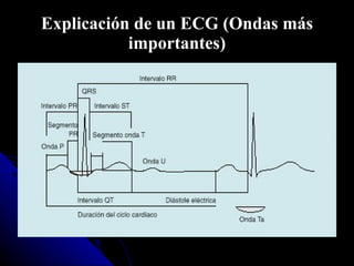 Explicación de un ECG (Ondas más importantes) 