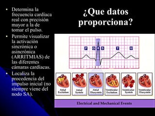 ¿Que datos proporciona? Determina la frecuencia cardíaca real con precisión mayor a la de tomar el pulso.  Permite visualizar la activación sincrónica o asincrónica (ARRITMIAS) de las diferentes cámaras cardíacas.  Localiza la procedencia del impulso inicial (no siempre viene del nodo SA).   