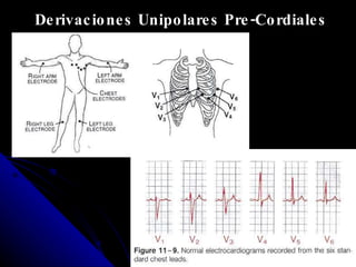 Derivaciones Unipolares Pre-Cordiales 