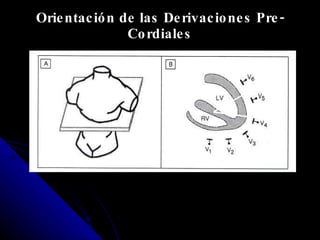Orientación de las Derivaciones Pre-Cordiales 