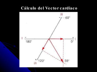 Cálculo del Vector cardiaco 