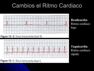 Cambios el Ritmo Cardiaco Bradicardia : Ritmo cardiaco bajo Taquicardia : Ritmo cardiaco rápido 