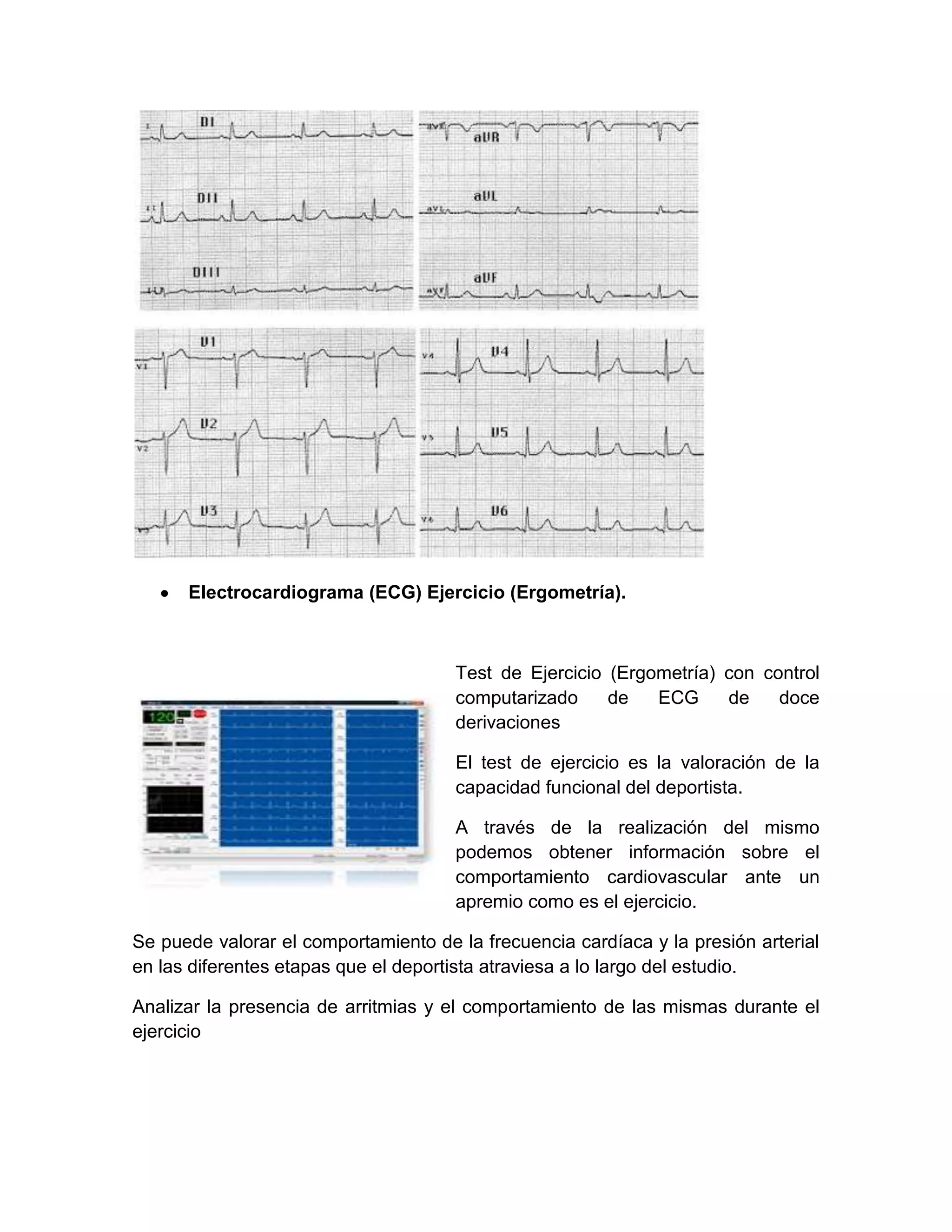Electrocardiograma (ECG) Ejercicio (Ergometría).



                                      Test de Ejercicio (Ergometría) con control
                                      computarizado     de   ECG     de    doce
                                      derivaciones

                                      El test de ejercicio es la valoración de la
                                      capacidad funcional del deportista.

                                      A través de la realización del mismo
                                      podemos obtener información sobre el
                                      comportamiento cardiovascular ante un
                                      apremio como es el ejercicio.

Se puede valorar el comportamiento de la frecuencia cardíaca y la presión arterial
en las diferentes etapas que el deportista atraviesa a lo largo del estudio.

Analizar la presencia de arritmias y el comportamiento de las mismas durante el
ejercicio
 