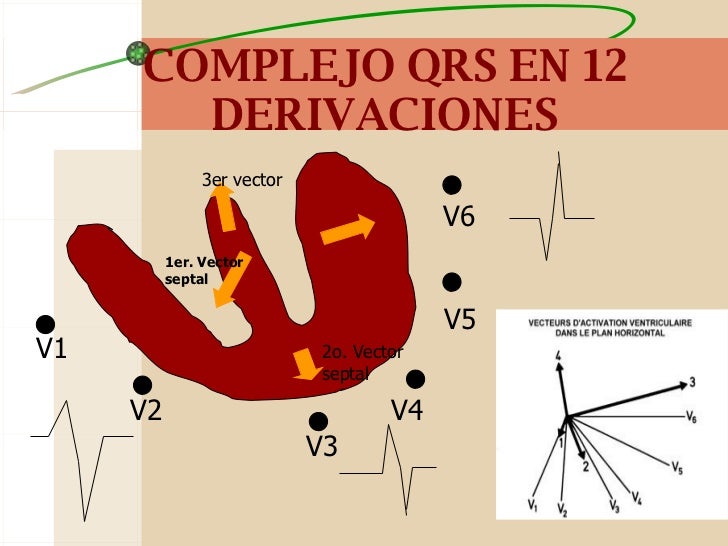 Derivaciones Que Ven La Cara Septal