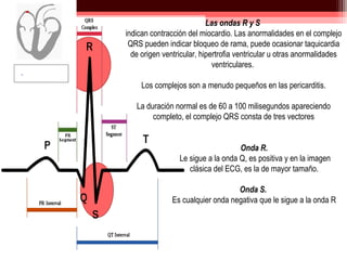 Onda R Ecg Electrocardiograma | PPT