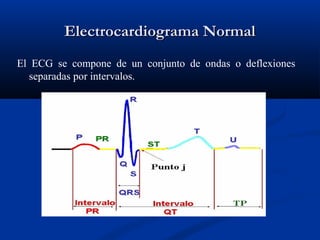Electrocardiograma Normal
El ECG se compone de un conjunto de ondas o deflexiones
  separadas por intervalos.
 