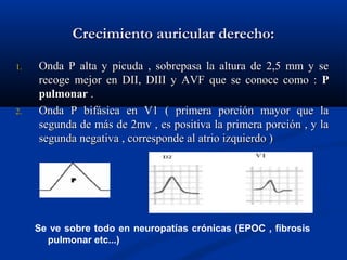 Crecimiento auricular derecho:

1.   Onda P alta y picuda , sobrepasa la altura de 2,5 mm y se
     recoge mejor en DII, DIII y AVF que se conoce como : P
     pulmonar .
2.   Onda P bifásica en V1 ( primera porción mayor que la
     segunda de más de 2mv , es positiva la primera porción , y la
     segunda negativa , corresponde al atrio izquierdo )




     Se ve sobre todo en neuropatías crónicas (EPOC , fibrosis
       pulmonar etc...)
 