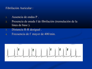 Fibrilación Auricular :

1.   Ausencia de ondas P .
2.   Presencia de onada f de fibrilación (tremulación de la
     linea de base ).
3.   Distancia R-R desigual .
4.   Frecuencia de f mayor de 400/min.
 