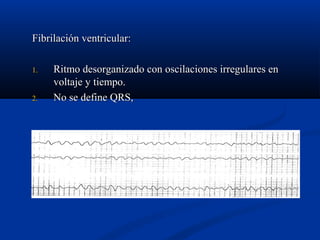 Fibrilación ventricular:

1.   Ritmo desorganizado con oscilaciones irregulares en
     voltaje y tiempo.
2.   No se define QRS,
 