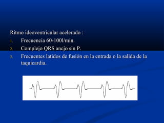 Ritmo ideoventricular acelerado :
1.  Frecuencia 60-100l/min.
2.  Complejo QRS ancjo sin P.
3.  Frecuentes latidos de fusión en la entrada o la salida de la
    taquicardia.
 