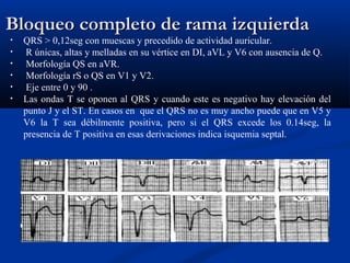 Bloqueo completo de rama izquierda
•   QRS > 0,12seg con muescas y precedido de actividad auricular.
•   R únicas, altas y melladas en su vértice en DI, aVL y V6 con ausencia de Q.
•   Morfología QS en aVR.
•   Morfología rS o QS en V1 y V2.
•   Eje entre 0 y 90 .
•   Las ondas T se oponen al QRS y cuando este es negativo hay elevación del
    punto J y el ST. En casos en que el QRS no es muy ancho puede que en V5 y
    V6 la T sea débilmente positiva, pero si el QRS excede los 0.14seg, la
    presencia de T positiva en esas derivaciones indica isquemia septal.
 