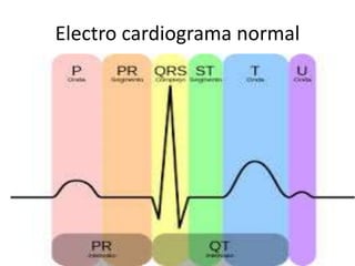 Electro cardiograma normal
 