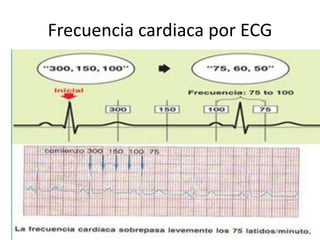 Frecuencia cardiaca por ECG
 
