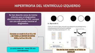 HIPERTROFIA DEL VENTRÍCULO IZQUIERDO
Se han descrito cerca de treinta
criterios para el diagnostico
electrocardiográfico de HVI, aunque
con uno solo puede hacerse el
diagnostico.
Uno de los mas usados es el índice de
SOKOLOV
Consiste en medir la S en V1 o V2
( SE TOMA LA MAYOR DE ESTAS
DOS) y la R en V5 o V6.
La suma debe ser menor 35 mm
(normalmente)
 