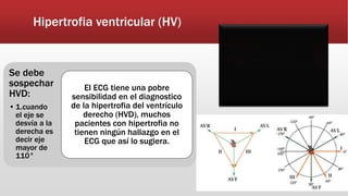 Hipertrofia ventricular (HV)
Se debe
sospechar
HVD:
• 1.cuando
el eje se
desvía a la
derecha es
decir eje
mayor de
110°
El ECG tiene una pobre
sensibilidad en el diagnostico
de la hipertrofia del ventrículo
derecho (HVD), muchos
pacientes con hipertrofia no
tienen ningún hallazgo en el
ECG que así lo sugiera.
 