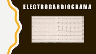 ELECTROCARDIOGRAMA
 