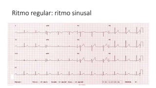 Electrocardiograma.pptx