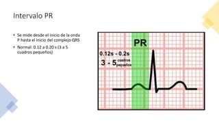 Complejo QRS
• Representa la despolarización
ventricular
• Normalmente: < 0.12 s
 