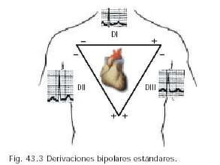 electrocardiograma.ppt