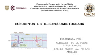 CONCEPTOS DE ELECTROCARDIOGRAMA
PRESENTADA POR :
GONZALEZ DE LA TORRE
ITZEL PAMELA
ROBLES FLORES MA. DE LOS
ANGELES
 