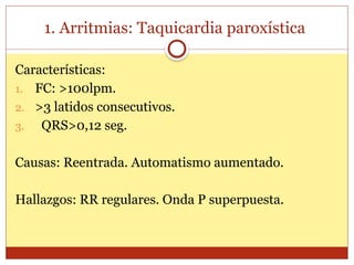 1. Arritmias: Taquicardia paroxística
Características:
1. FC: >100lpm.
2. >3 latidos consecutivos.
3. QRS>0,12 seg.
Causas: Reentrada. Automatismo aumentado.
Hallazgos: RR regulares. Onda P superpuesta.
 