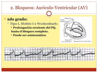 2. Bloqueos: Auriculo-Ventricular (AV)
 2do grado:
 Tipo I, Mobitz I o Weckenbach:
 Prolongación creciente del PQ,
hasta el bloqueo completo.
 Puede ser asintomático.
 