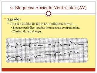 2. Bloqueos: Auriculo-Ventricular (AV)
 2 grado:
 Tipo II o Mobitz II: IM, HTA, antihipertensivos.
 Bloqueo periódico, seguido de una pausa compensadora.
 Clínica: Mareo, síncope.
 
