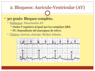 2. Bloqueos: Auriculo-Ventricular (AV)
 3er grado: Bloqueo completo.
 Hallazgos: Disociación AV.
 Ondas P regulares al igual que los complejos QRS.
 FC: Dependiente del marcapaso de relevo.
 Clínica: mareos, síncope, Stokes-Adams.
 