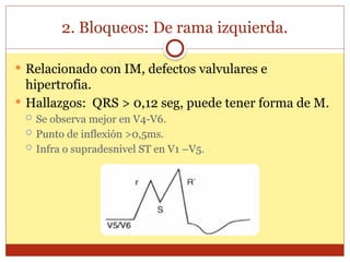 2. Bloqueos: De rama izquierda.
 Relacionado con IM, defectos valvulares e
hipertrofia.
 Hallazgos: QRS > 0,12 seg, puede tener forma de M.
 Se observa mejor en V4-V6.
 Punto de inflexión >0,5ms.
 Infra o supradesnivel ST en V1 –V5.
 