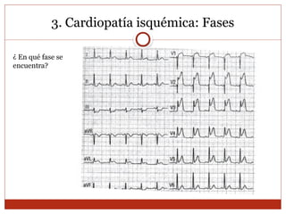 3. Cardiopatía isquémica: Fases
¿ En qué fase se
encuentra?
 
