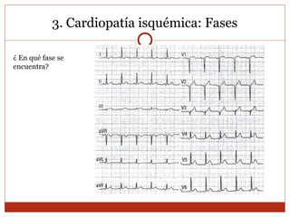 3. Cardiopatía isquémica: Fases
¿ En qué fase se
encuentra?
 