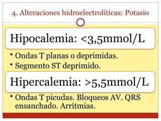 4. Alteraciones hidroelectrolíticas: Potasio
Hipocalemia: <3,5mmol/L
• Ondas T planas o deprimidas.
• Segmento ST deprimido.
Hipercalemia: >5,5mmol/L
• Ondas T picudas. Bloqueos AV. QRS
ensanchado. Arritmias.
 