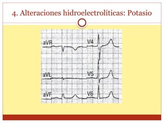 4. Alteraciones hidroelectrolíticas: Potasio
 