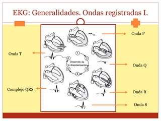 EKG: Generalidades. Ondas registradas I.
Onda P
Onda Q
Onda R
Onda S
Complejo QRS
Onda T
 