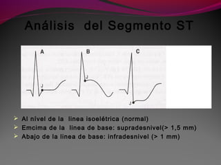 Análisis del Segmento ST
 Al nível de la linea isoelétrica (normal)
 Emcima de la linea de base: supradesnivel(> 1,5 mm)
 Abajo de la linea de base: infradesnivel (> 1 mm)
 