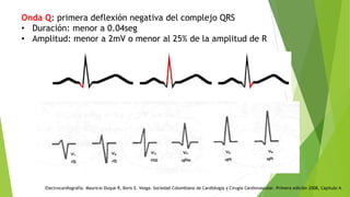 Onda R Ecg ELECTROCARDIOGRAMA clase r1 medicina .pptx