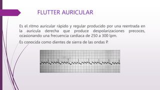 ELECTROCARDIOGRAMA Archivo Acerca De Las Ondas PPTX ELECTROCARDIOGRAMA Archivo Acerca De Las Ondas PPTX