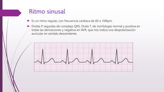 ELECTROCARDIOGRAMA( archivo acerca de las ondas) | PPT