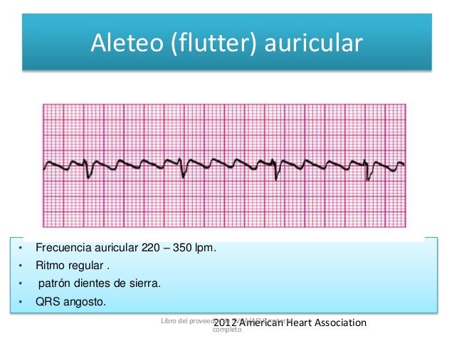 ekg-y-reconocimiento-de-ritmo