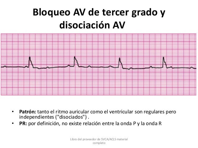 EKG Y RECONOCIMIENTO DE RITMO