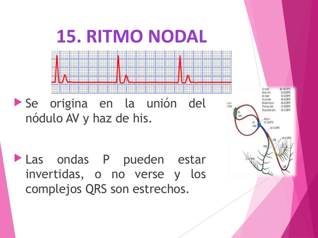 Electrocardiograma anormal Electrocardiograma anormal
