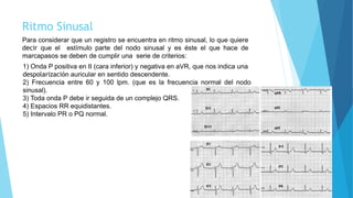 Electrocardiograma Basica | PPT