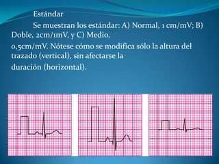 Estándar
Se muestran los estándar: A) Normal, 1 cm/mV; B)
Doble, 2cm/1mV, y C) Medio,
0,5cm/mV. Nótese cómo se modifica sólo la altura del
trazado (vertical), sin afectarse la
duración (horizontal).
 