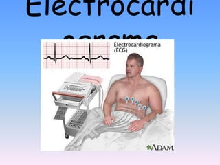 Electrocardi
   ograma
 
