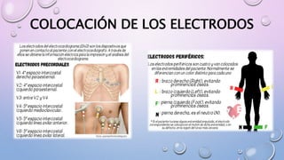 COLOCACIÓN DE LOS ELECTRODOS
 