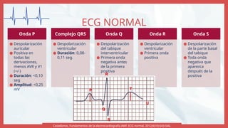 Seg Normal Definition Ekg normal y patológico, bloqueos de rama derecha e izquierda | PPTX