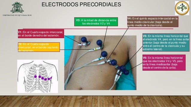 Electrocardiograma ecg/ekg