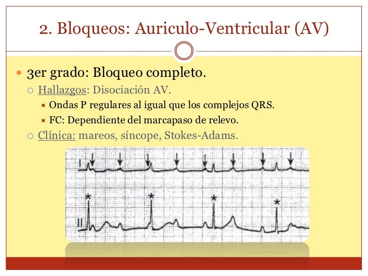 Electrocardiograma (ekg)
